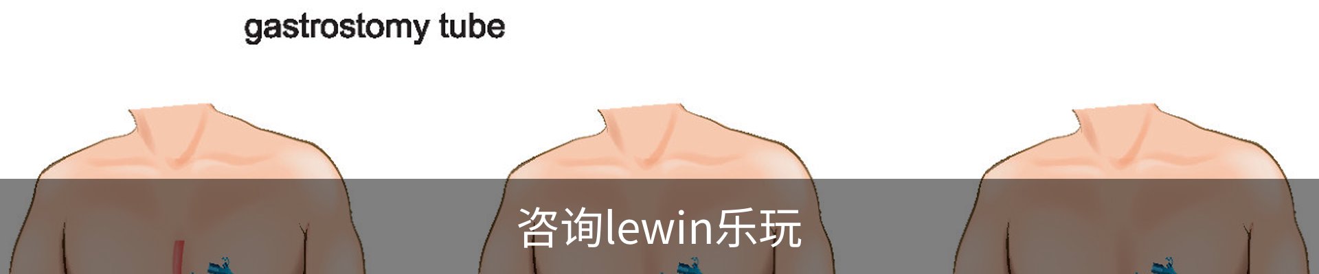 咨询lewin乐玩